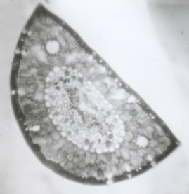 Wet-printed thin section from X-Ray film exposed with the Kodak No.0 and Model R