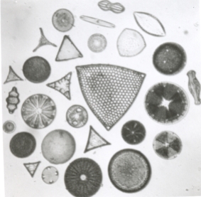 Wet-printed diatoms from X-Ray film exposed with the Kodak No.0 and Model R